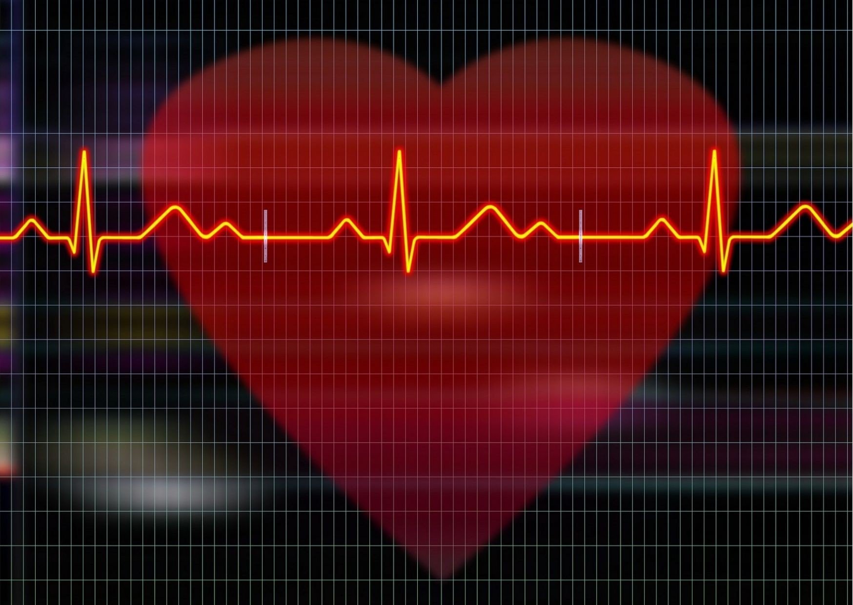 What Are the Most Common Cardiovascular Diseases?